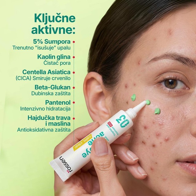 AKNE-NA,LICU